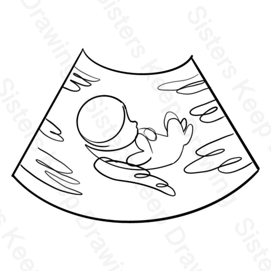 Ultrasound with Angel Wings - Miscarriage Awareness - Tattoo Transparent PNG